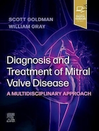 Diagnosis and Treatment of Mitral Valve Disease A Multidisciplinary Approach | تشخیص و درمان بیماری دریچه میترال با رویکرد چند رشته ای